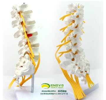 ENOVO正品医用人体五节腰椎模型 马尾神经坐骨神经模脊椎骨科模型