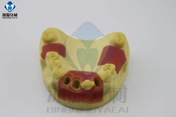 牙科教学模型口腔科种植牙练习模型上颌缺失牙仿骨质仿真牙龈包邮